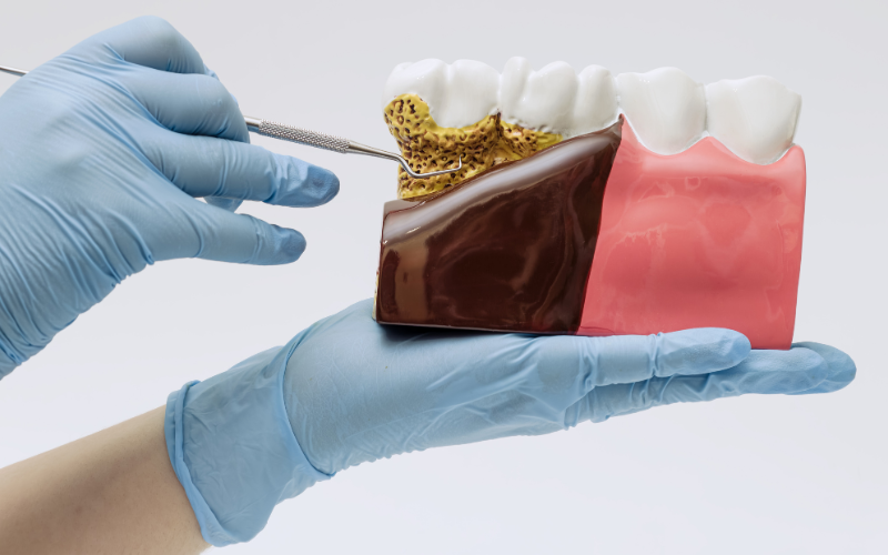 mastic gum oral benefits